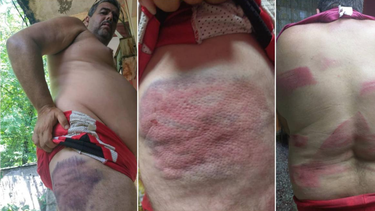 un opositor cubano sufre una brutal golpiza con un bate: mi enemigo es la seguridad del estado