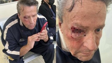 actor mexicano recibe fuerte golpiza afuera de su casa + foto