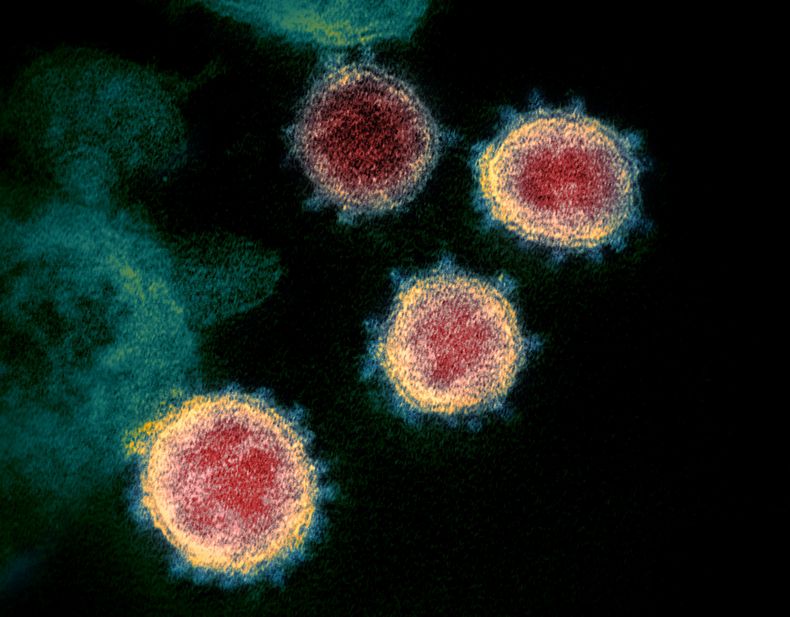 EUR-GEN_CORONAVIRUS-TESTS_RAPIDOS-0.jpg