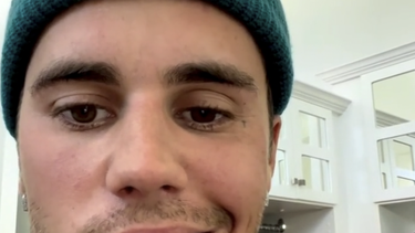 justin bieber confeso que sufre de paralisis en la mitad del rostro por un virus: es muy grave