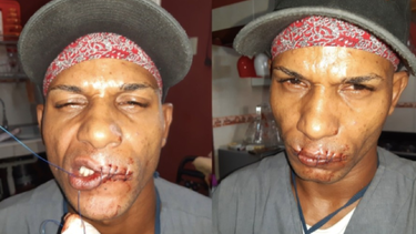 maykel osorbo se cose la boca ante hostigamiento del regimen