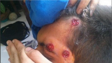 varios jovenes heridos en otra jornada de manifestaciones estudiantiles en venezuela
