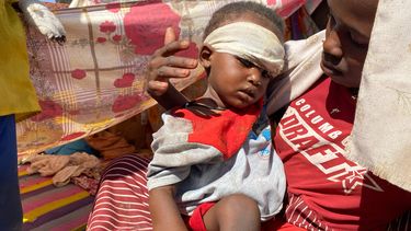 Un niño sudanés que huyó de la ciudad de el-Fasher con su familia después de que las fuerzas paramilitares de Sudán asesinaran a cientos de personas en la región occidental de Darfur, recibe tratamiento en un campamento de Tawila, Sudán, el domingo 2 de noviembre de 2025. (AP Foto/Mohammed Abaker)