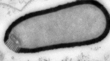 americateve | Esta imagen de microscopio electr&oacute;nico provista por investiggadores en marzo de 2014 muestra una secci&oacute;n de una part&iacute;cula pithovirus dentro de una c&eacute;lula infectada de Acanthamoeba castellanii. La part&iacute;cula tiene una long